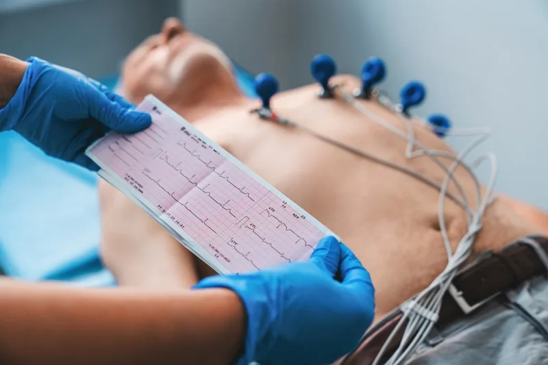 Realización de electrocardiograma 12 derivaciones
