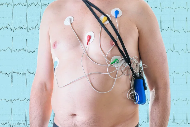 Realización de Holter 24, 48 y 72 horas